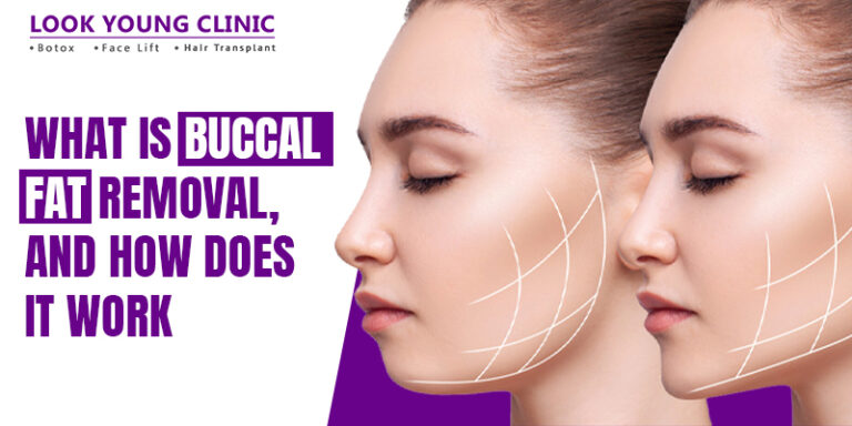 what-is-buccal-fat-removal-and-how-does-it-work-look-young-clinic