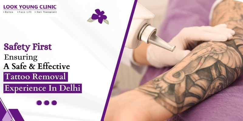 Tattoo-Removal-in-Delhi