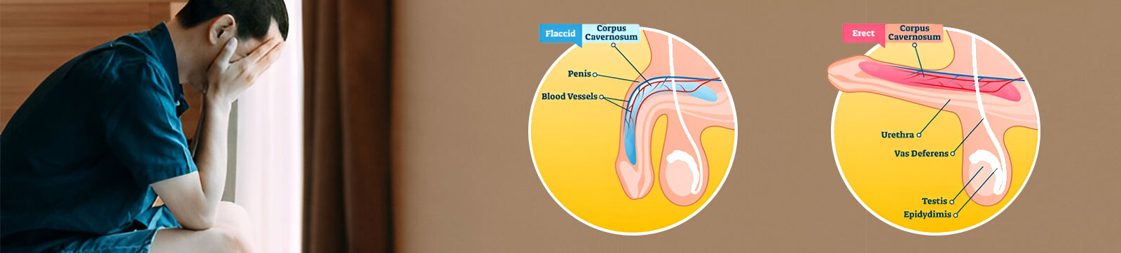 PRP therapy