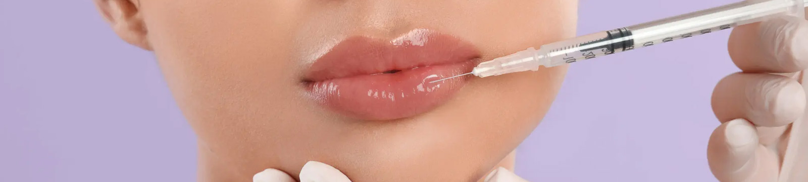 Lip Filler Treatment